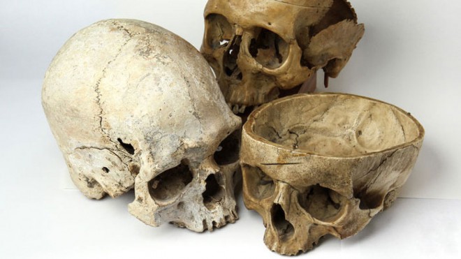 该藏品还包括人类头骨碎片。照片：迷你博物馆