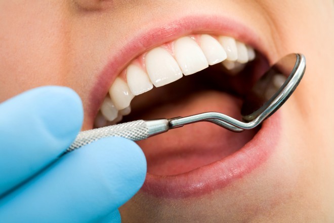 Zrcalce, zrcalce v zobozdravnikovih rokah povej, kateri zob najlepši v ustni votlini je tej?