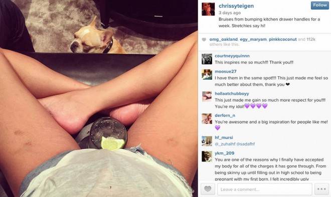 Chrissy Teigen teda zdieľala fotku svojich strií na sociálnej sieti Instagram.