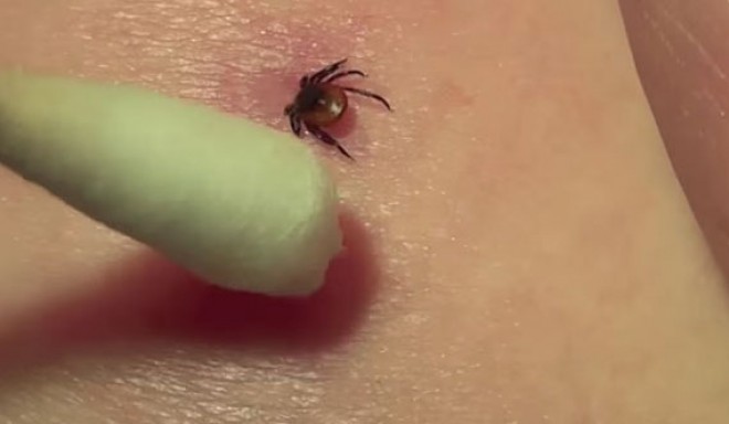 You can remove the tick with a cotton swab.