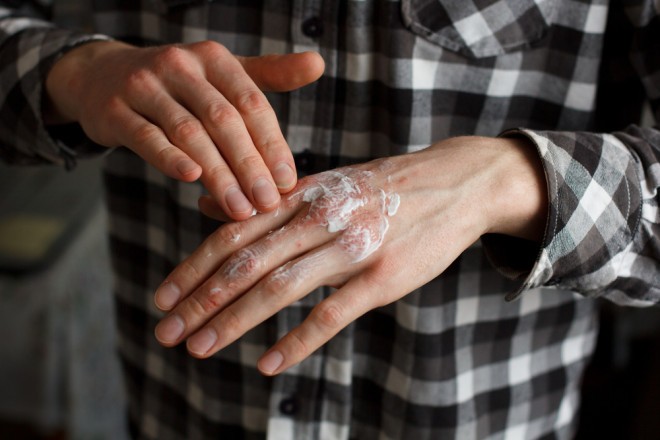 Let homemade hand cream help you with dry hand skin.