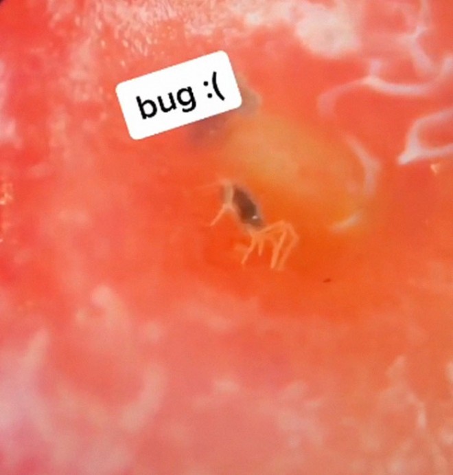 The Bug in the Strawberry (@thatnatchats on TikTok)